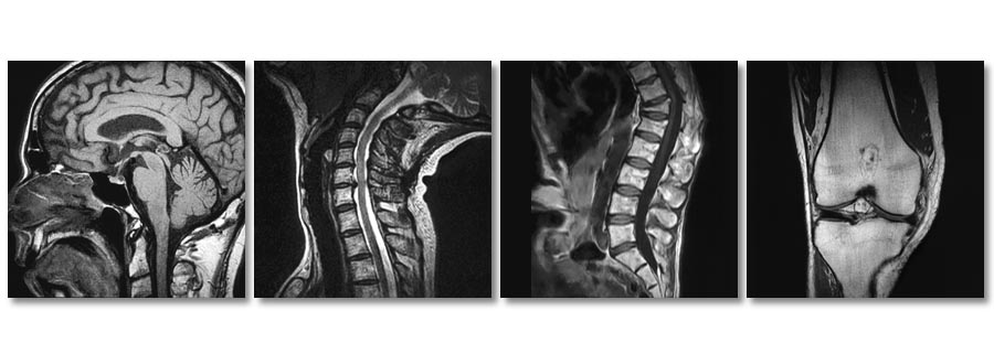 Capital Region Upright MRI